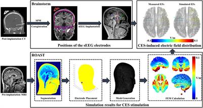 In vivo Measurements of Electric Fields During Cranial Electrical Stimulation in the Human Brain